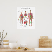 Poster Embolisme Pulmonaire, Voie D'Embolus (Cuisine)