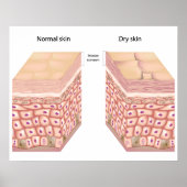 Poster en peau sèche (Devant)