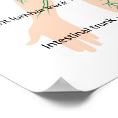 Poster étiqueté de drainage lymphatique (Coin)