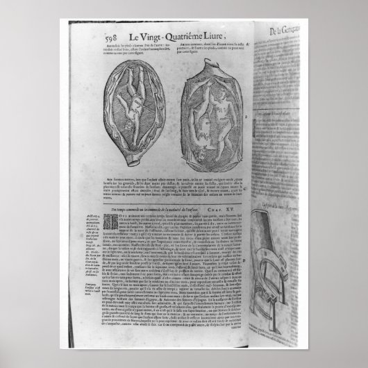 Poster Foetus, illustration de 'Oeuvres' (Devant)