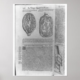 Poster Foetus, illustration des 'oeuvres