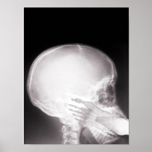 Poster Foot à Mouth X-Ray (Devant)