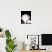 Poster Foot à Mouth X-Ray (Bureau à domicile)