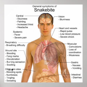 Poster General Symtoms Chart of a Snakebite Poisoning