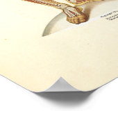 Poster Graphique d'anatomie musculaire humaine (Coin)