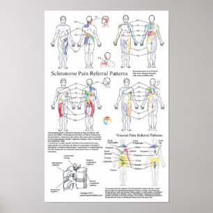 Poster Graphique de référence de la douleur viscérale de 