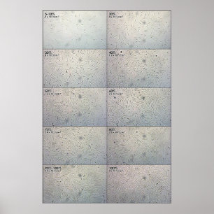 Poster Graphique de suivi de confluence