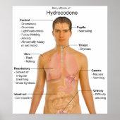 Poster Graphique des effets secondaires de l'hydrocodone  (Devant)