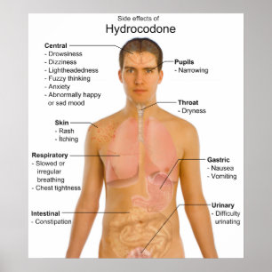 Poster Graphique des effets secondaires de l'hydrocodone 