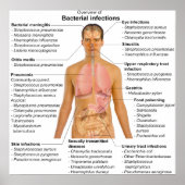 Poster Graphique des principales infections bactériennes (Devant)