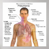 Poster Graphique des symptômes de la pneumonie (Devant)