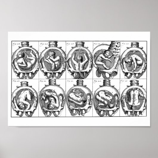 Poster Illustration de l'anatomie du bébé dans l'utérus V (Devant)