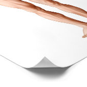 Poster Illustration Médicale D'Un Appendice (Coin)