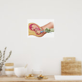 Poster Illustration Montrant La Livraison Du Foetus 1 (Cuisine)
