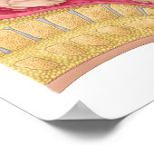 Poster Illustration Montrant La Livraison Du Foetus 2 (Coin)