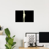 Poster Illustration Of Knee Bone, Straight (Bureau à domicile)