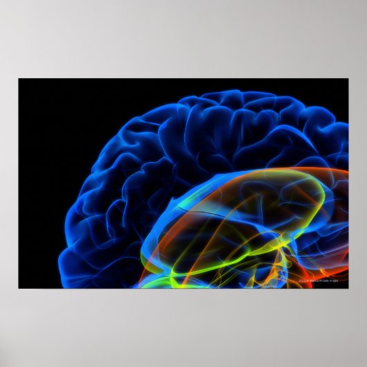 Poster Image par rayons X du cerveau (Devant)