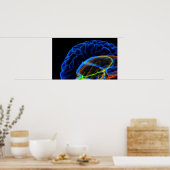 Poster Image par rayons X du cerveau (Cuisine)