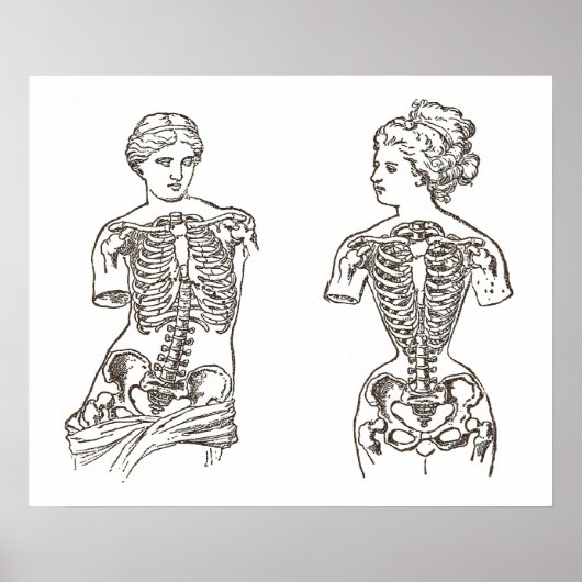 Poster Impact physique du port des corsets Médicale Impre (Devant)