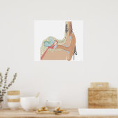 Poster Implants cochléaires (Cuisine)