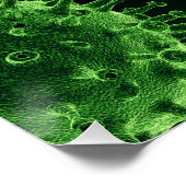 Poster Infection à l'agent pathogène du virus du col de l (Coin)