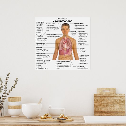 Poster Infections virales et espèces en cause Graphique (Cuisine)