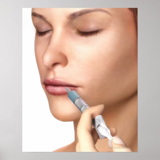 Poster Injections Botox (Devant)
