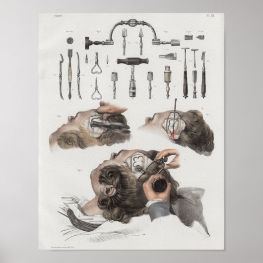 Poster Instruments de chirurgie cérébrale Anatomie Vintag (Devant)