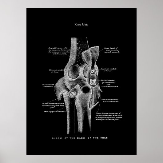 Poster Joints genou Anatomie Art (Devant)
