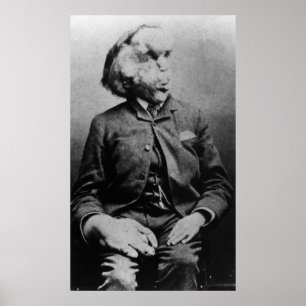 Poster Joseph "John" Merrick L'homme éléphant de 1889