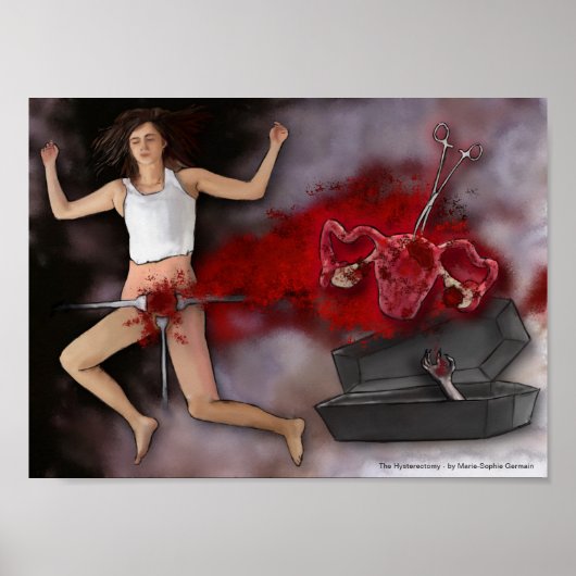 Poster L'hystérectomie (Devant)