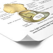 Poster Ligaments de hanche et Pelvis Anatomie des os (Coin)