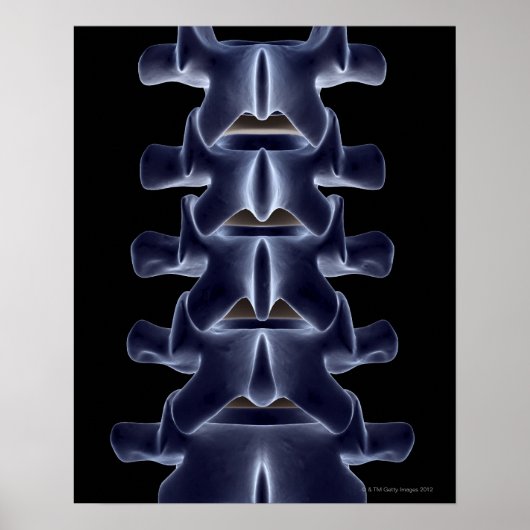 Poster Lumbar Vertebra 2 (Devant)
