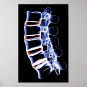 Poster Lumbar Vertebrae (Devant)