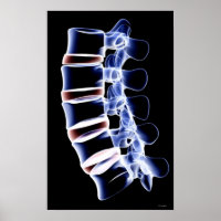 Lumbar Vertebrae
