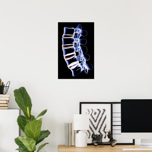 Poster Lumbar Vertebrae (Bureau à domicile)
