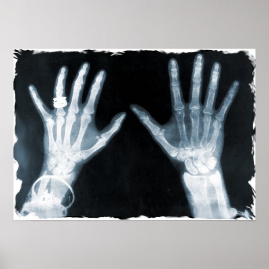 Poster Mains et bijoux en squelette X-Ray - bleu (Devant)