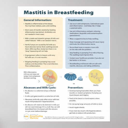 Poster Mastitis dans l'affiche d'allaitement (anglais) (Devant)