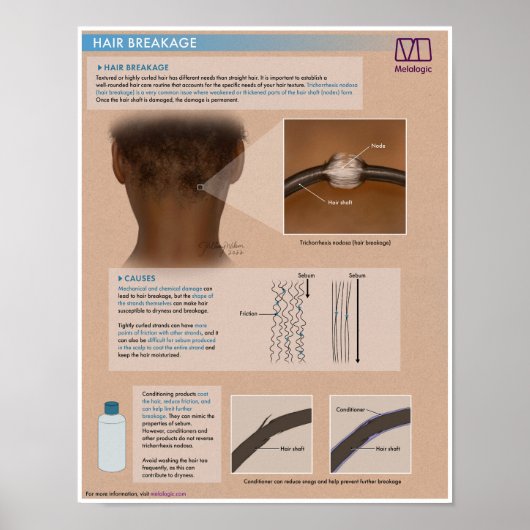 Poster Médicale de la rupture des cheveux de la mé (Devant)