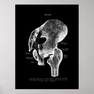 Poster Médicale de l'anatomie de la hanche