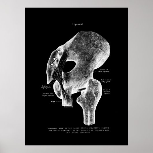 Poster Médicale de l'anatomie de la hanche (Devant)