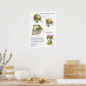 Poster Médicale de l'anatomie du syndrome de l'art (Cuisine)