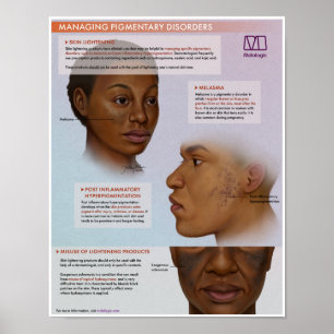 Poster Médicale d'éclaircissement de la peau en mé