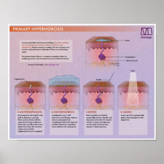 Poster Médicale d'Hyperhidrose Melalogique