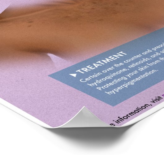 Poster Médicale d'Hyperpigmentation Melalogique (Coin)