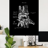 Poster Médicale Poster Poster Orthopédique Décor (Bureau à domicile)