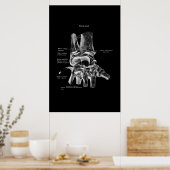 Poster Médicale Poster Poster Orthopédique Décor (Cuisine)