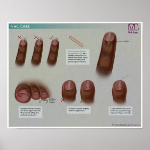 Poster Melalogic Nail Care Médicale