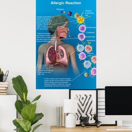 Poster met allergische reactie (Thuiskantoor)
