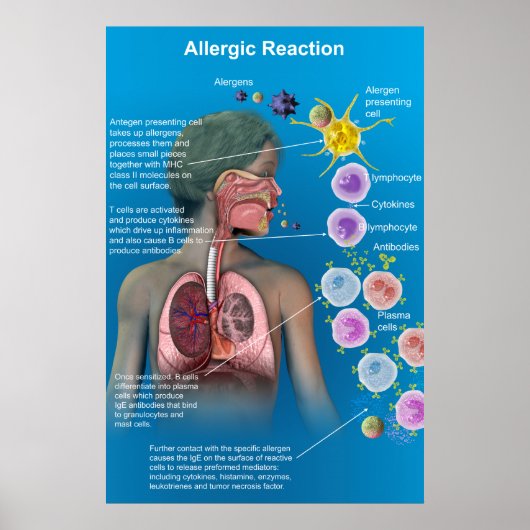 Poster met allergische reactie (Voorkant)